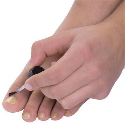 PediFix® FungaZoil® Advanced Antifungal Solution