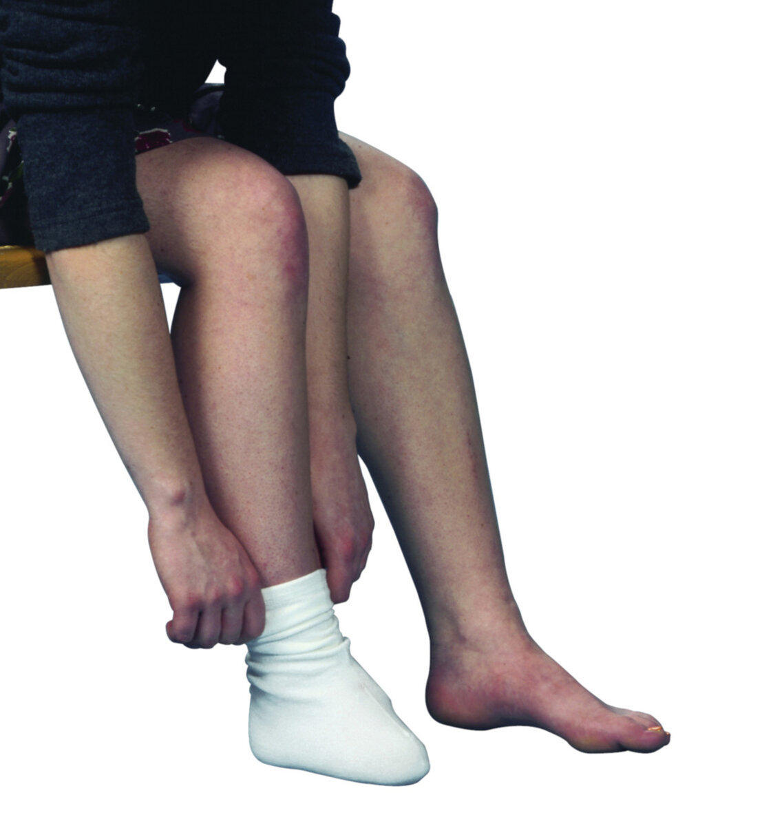 Derma Seal Trans Ped