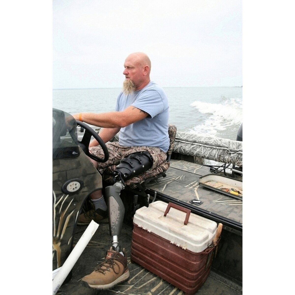 Transfemoral System Kit