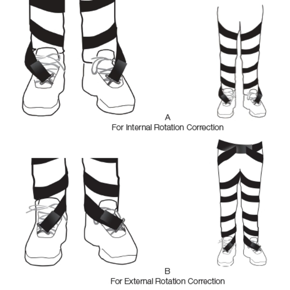 Rotator™ Derotation Strap