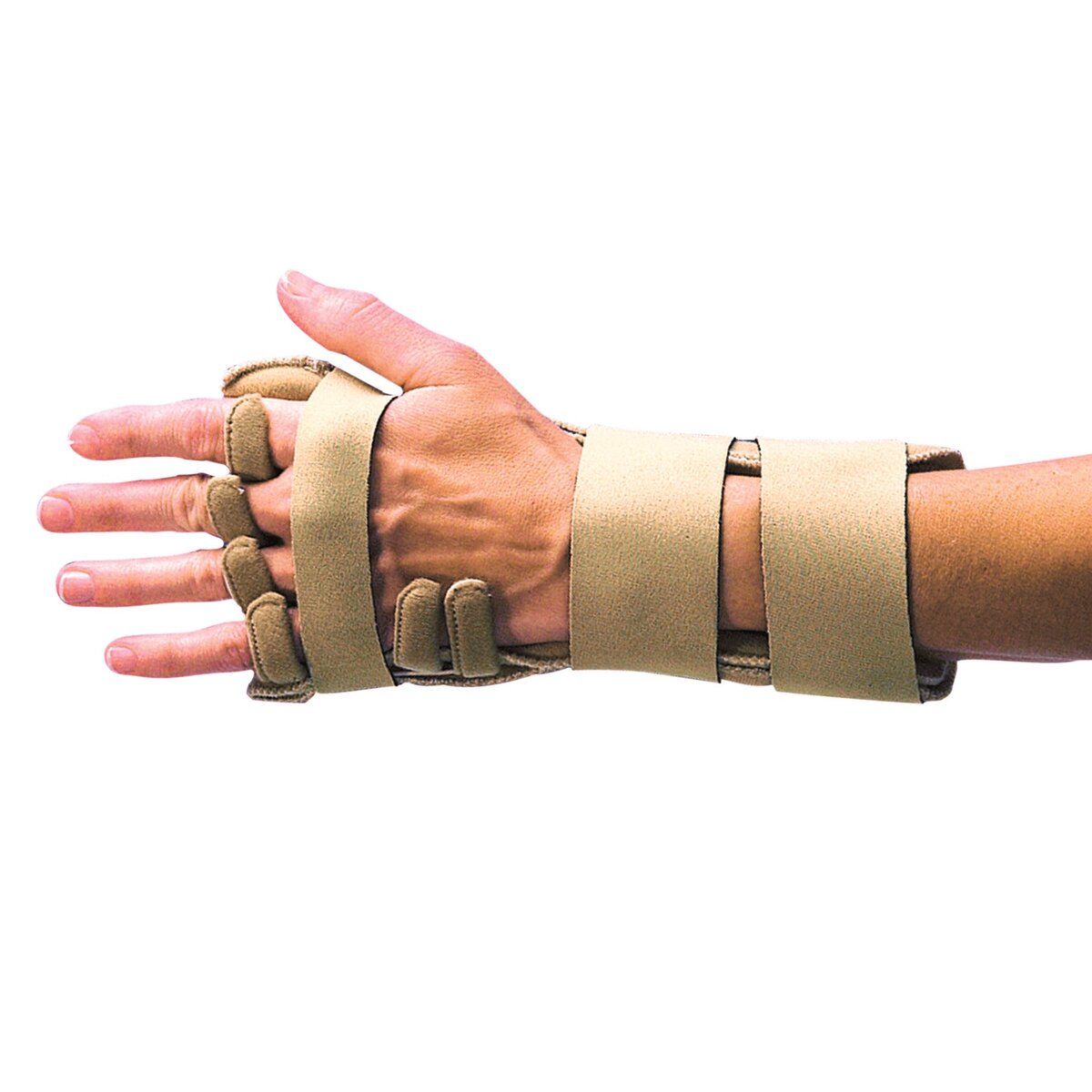3pp® Comforter™ Splint