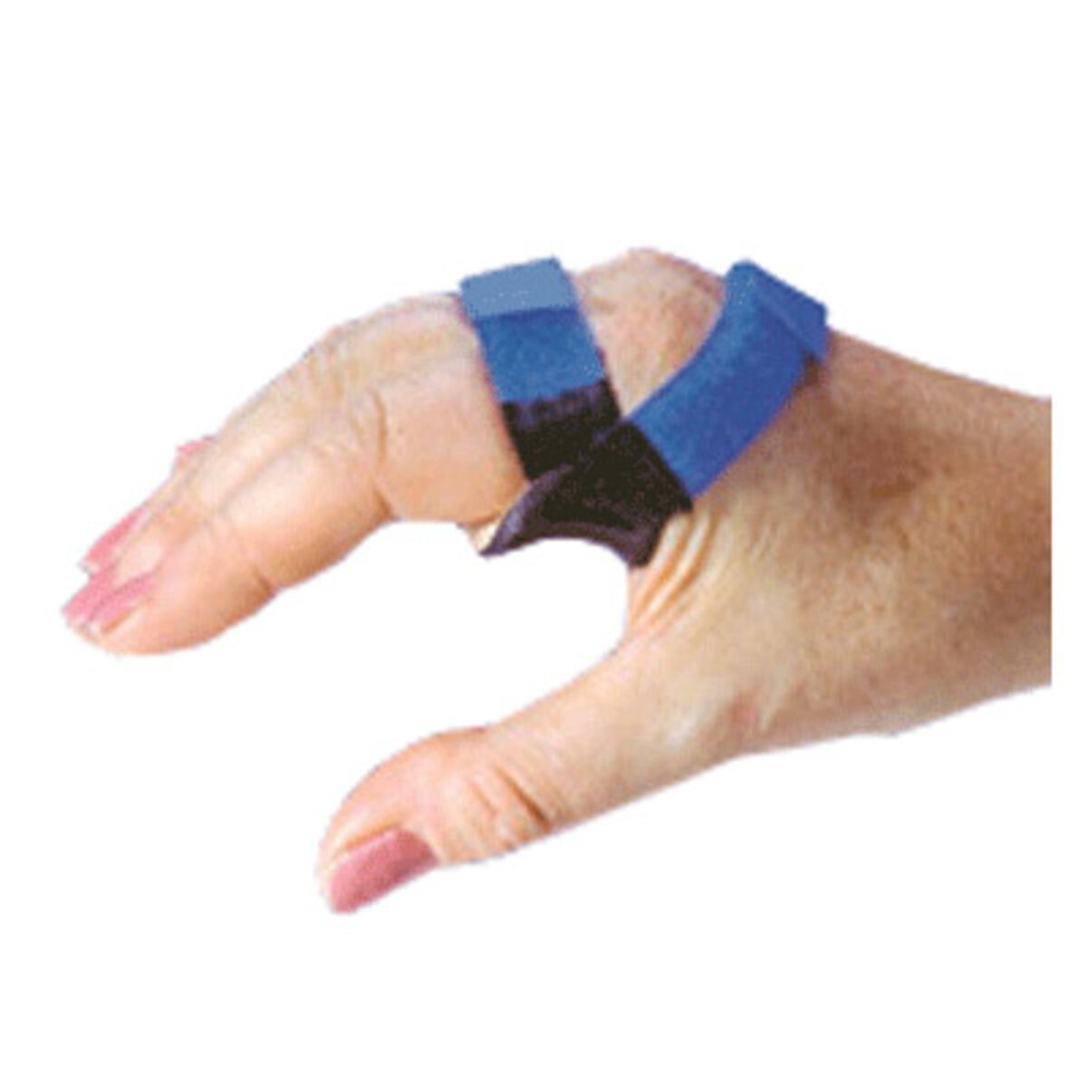 Short Ulnar Deviation Splint