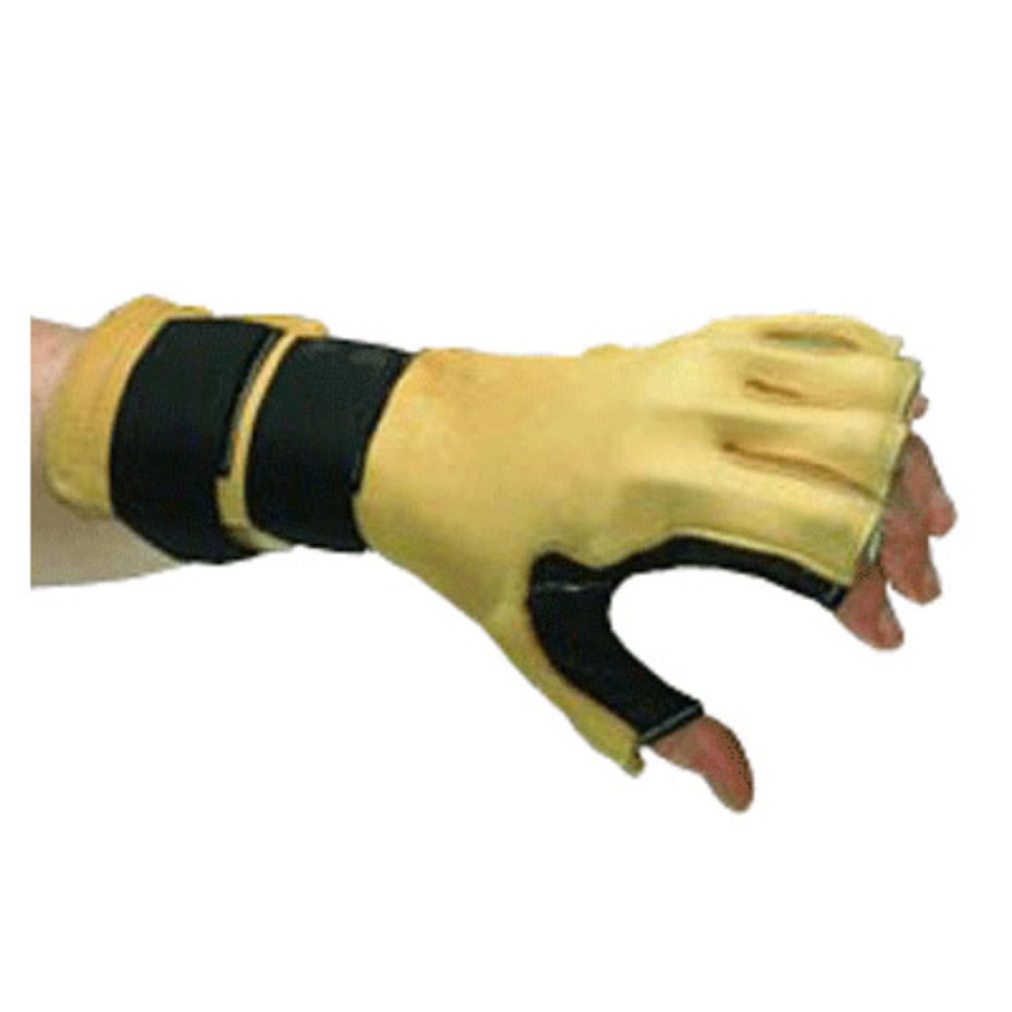 Robinson Forearm-Based Radial Nerve Splint | 510391/NA/LL