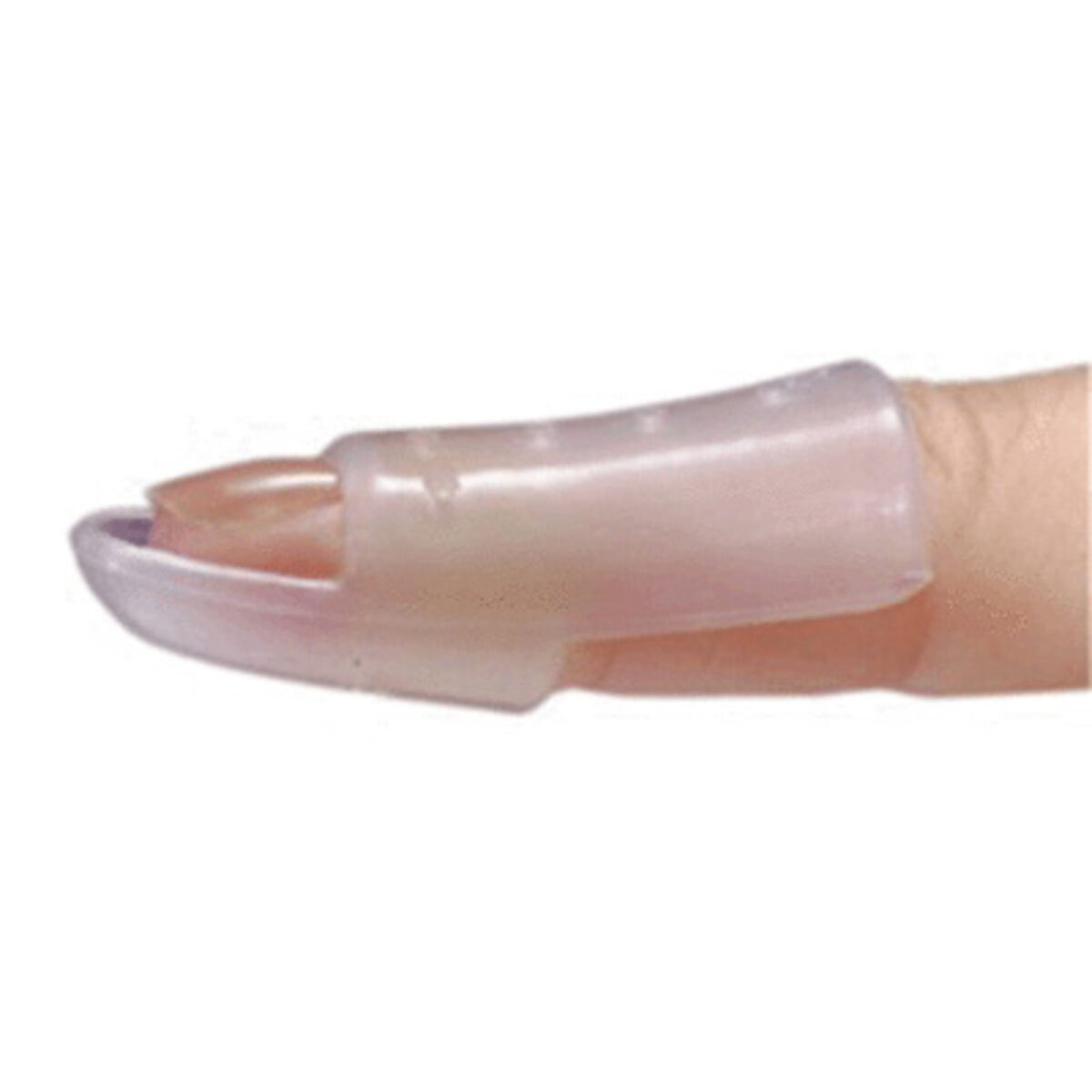 Stax-Type Splints