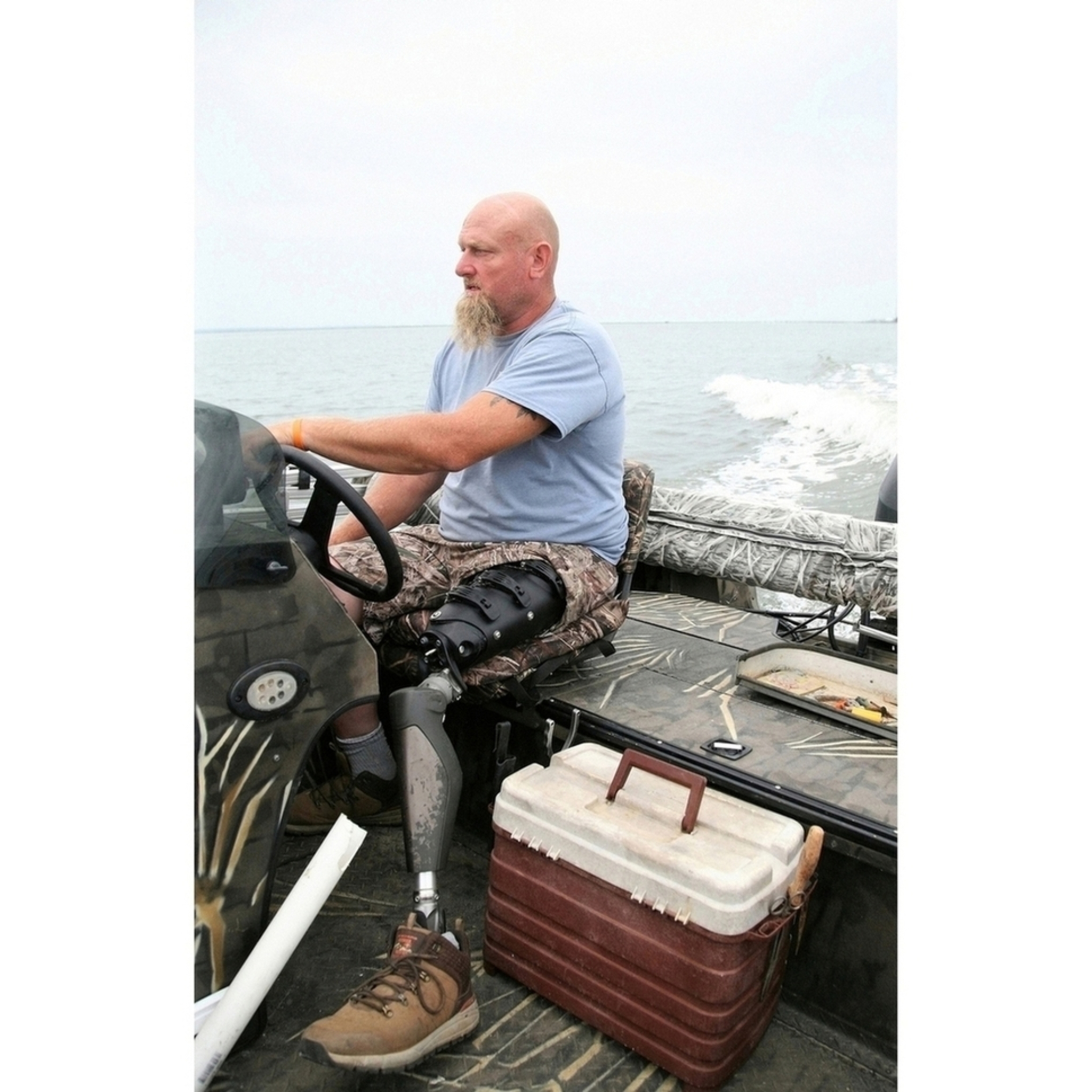 Transfemoral System Kit