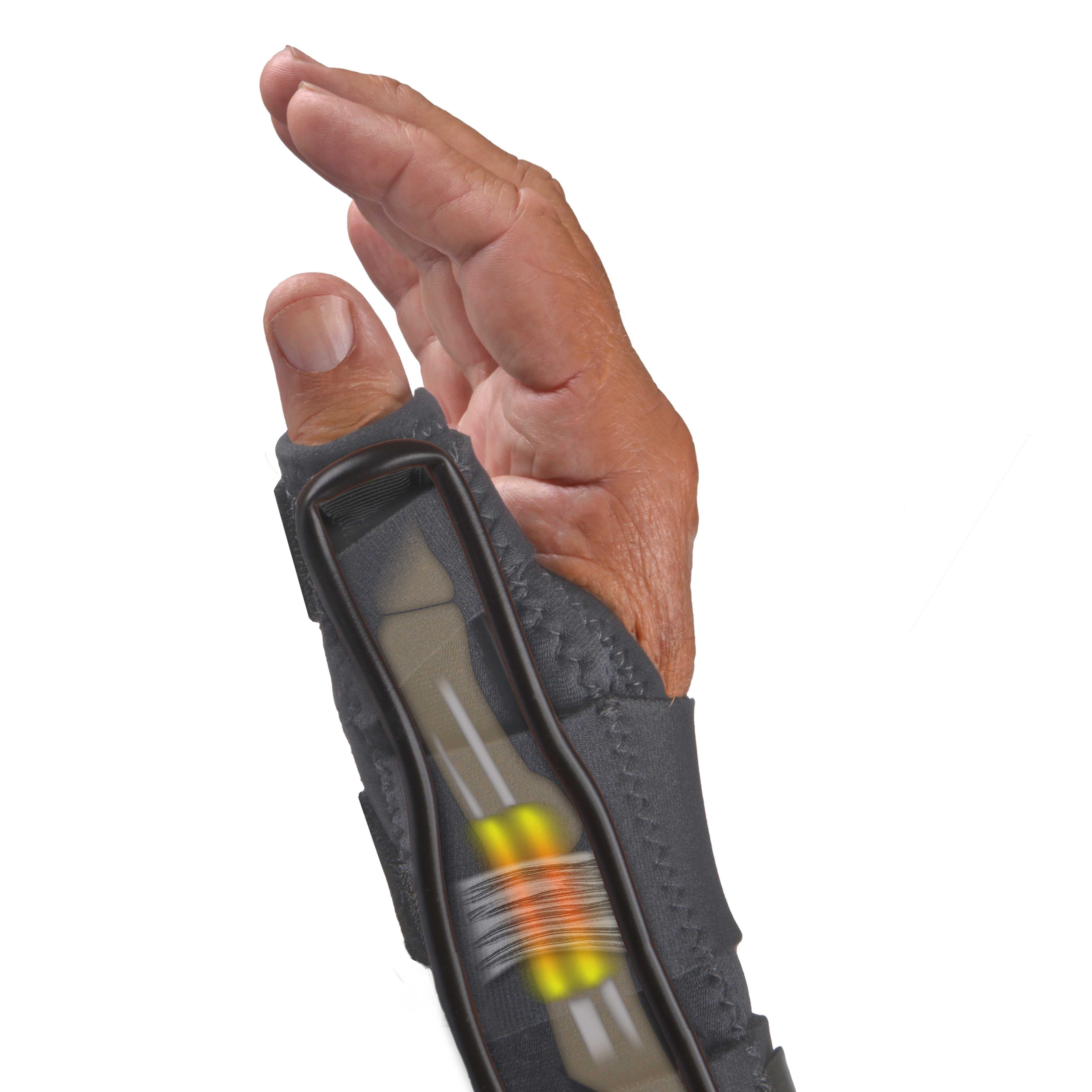 deQ™ Thumb Orthosis